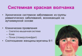 Всемирный день волчанки 10 мая